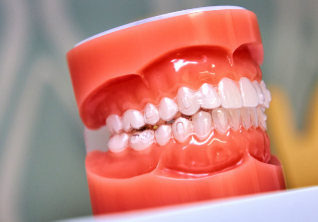 Invisalign